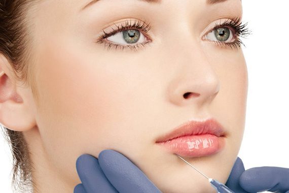 Lip Fillers