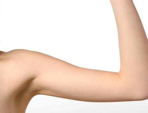 arm lift surgery