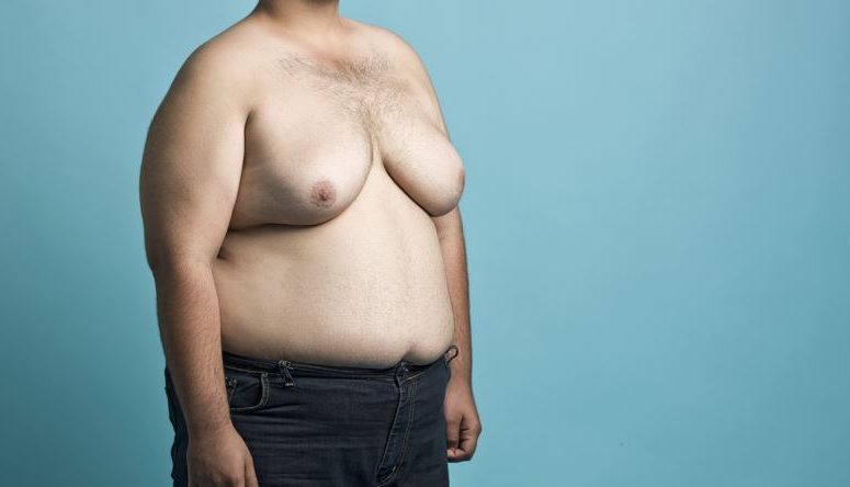 What is Gynecomastia?