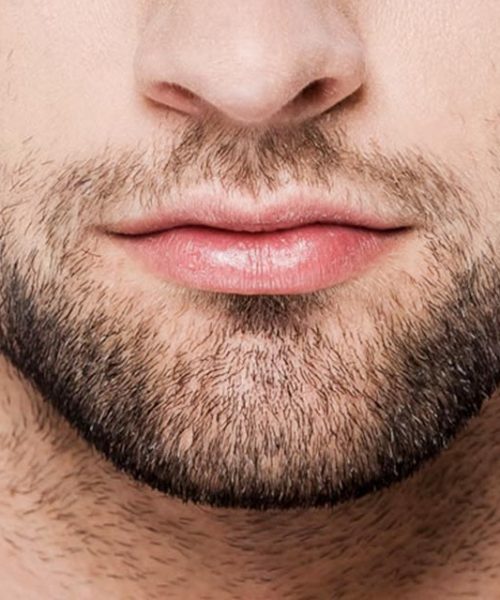 beard translant turkey